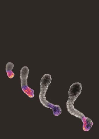 Somitoids, human stem cell-based 3D models that mimic early embryos, at different stages of development. The largest somitoid has visible somite-like segments. Credit - University of Dundee
